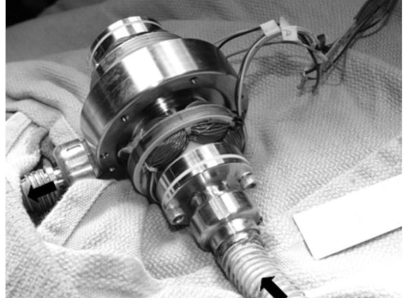 Tesla pump in medical use